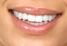 Cum se previne parodontoza în mod natural