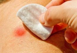 Cum tratam un coș mai mare sau un furuncul cu bicarbonat