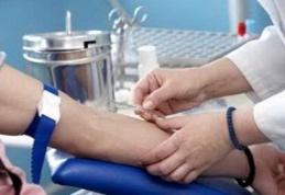 Nivelul colesterolului trebuie verificat înainte de împlinirea vârstei de 45 ani