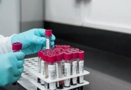 Proba prelevată de la o persoană din Dorohoi, suspectă de COVID-19, blocată de o firmă de curierat