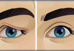 Suferiți de pleoape cazute? Nicio problemă, le puteți ridica în mod natural!