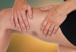 Semnele care anunță leucemia: care sunt persoanele cu risc