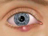 Ce spune medicul despre urciorul 