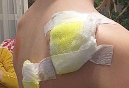 Revoltător! Doi adulți și o fetiță de 11 ani mușcate de un câine la Botoșani - FOTO