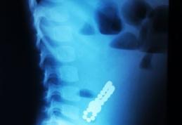 „Un cămin sigur pentru copilul tău” Atenție la obiectele mici care pot fi înghițite de copilași sau băgate în nas!