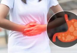 Ce trebuie să știi despre hiperaciditatea gastrică