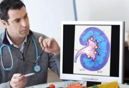 Cum se formează pietrele la rinichi