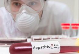 Cum se transmite hepatita C