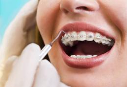 Vârsta maximă până la care sunt recomandate aparatele dentare