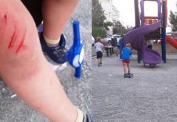 Cum procedăm când copiii se rănesc la joacă