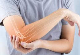 Ce trebuie să faci ca să previi osteoporoza