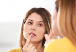 Trucuri pentru a scăpa rapid de herpes