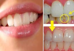 Sfaturi pentru a elimina tartrul dentar în mod natural