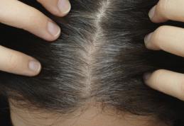 Cauze ale albirii părului de care nu știai