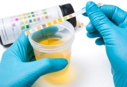 Ce spune culoarea urinei despre sănătatea ta