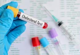 Cum să controlăm nivelul colesterolului