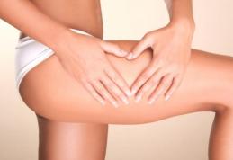 Dieta care ne poate scăpa de celulită