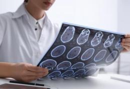 Simptome care anunţă scleroza multiplă