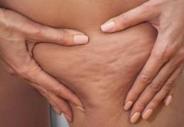 Adevăratul motiv pentru care femeile fac celulită