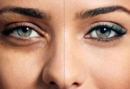 Aveți cercuri întunecate sub ochi? Ar trebui să scăpati de anumite obiceiuri