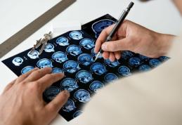 Semnele unui accident vascular cerebral