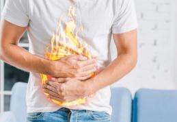 Alimente benefice pentru reducerea arsurilor la stomac