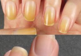Tratamente naturiste pentru unghii îngălbenite