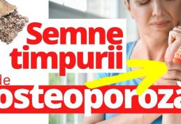 Iată ce trebuie să faci pentru a preveni osteoporoza!