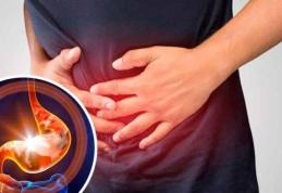Arsuri la stomac: remedii naturale și sfaturi de prevenție