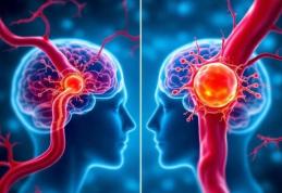 Cum putem recunoaște că s-a produs un accident vascular cerebral?