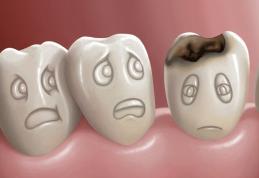 Cel mai bun aliment pentru prevenirea cariilor