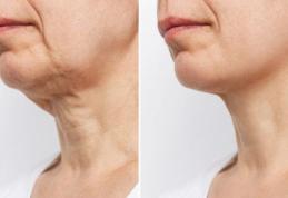 Cum poți evita îmbătrânirea prematură