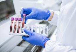 Care sunt cele mai importante analize de sânge?