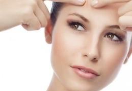 Învață cum să scapi de coșuri la orice vârstă