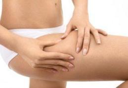 Adevăr şi fals despre celulită