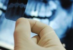 Cât de periculoase sunt radiografiile dentare