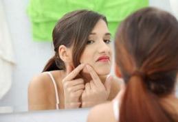 Cauze și remedii pentru acneea adultului
