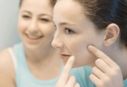 Cele mai bune uleiuri care tratează acneea