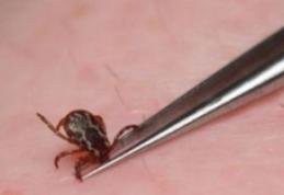 Cum să tratezi înţepătura de căpuşă cu tinctură de propolis