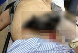 Șocant! A încercat să se sinucidă cu o seceră