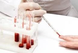 Descoperirea secolului. Un test de sânge ne va spune cât vom trăi