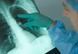 Cadrele didactice botoșănene vor începe noul an școlar cu un control medical