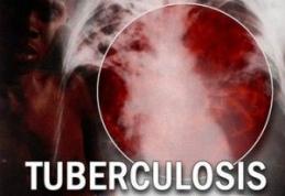 Lupta globală împotriva tuberculozei 