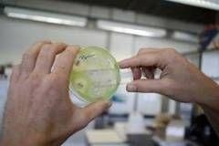   O superbacterie rezistentă la antibiotice a infectat jumătate de milion de oameni în India