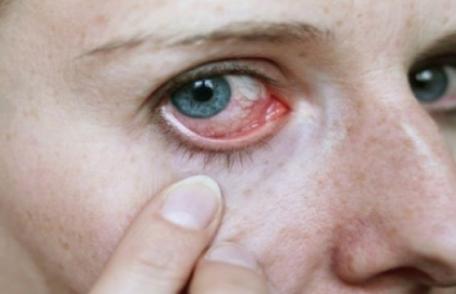 Afecțiuni care pot fi detectate printr-o simplă analiză a ochilor