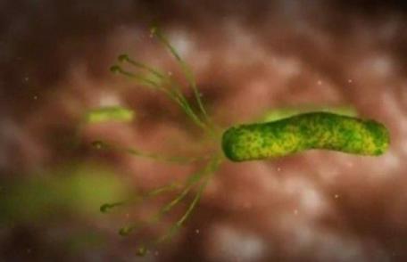Leguma care omoară bacteria helicobacter pilori, cea care cauzează ulcerul