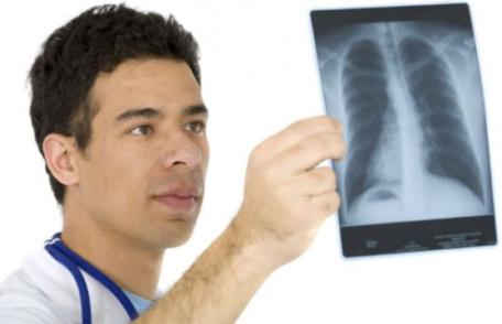 Toți fumătorii trebuie să știe asta. Cel mai bun remediu natural pentru curățarea plămânilor