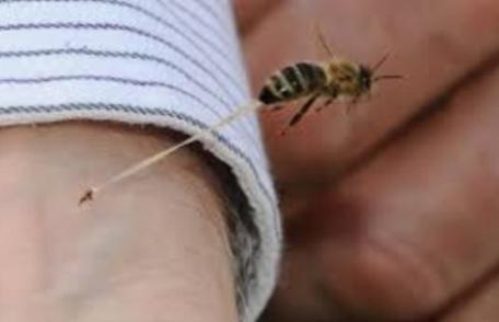 Cum să tratezi acasă înțepăturile de insecte. Uite cât de simplu e
