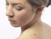 Lucruri obligatoriu de stiut despre alunite