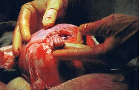 Cea mai importantă fotografie din istoria medicinii